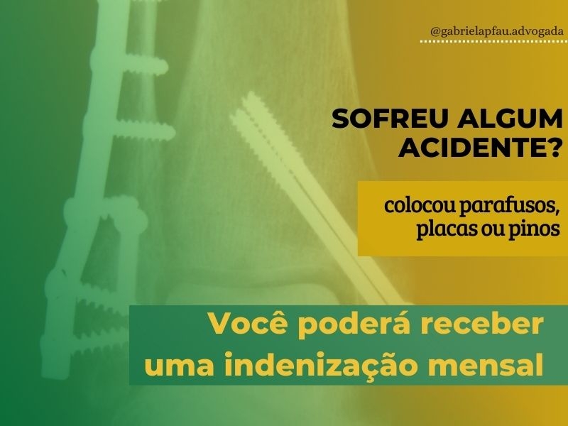  Auxílio - Acidente |  Indenização Mensal 